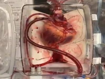 محققان ایرانی برای سلول‌های تپنده قلب بستر زیست مهندسی شده ساختند