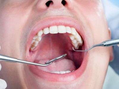 تشخیص سرطان و باکتری از طریق بزاق دهان با فناوری کریسپر